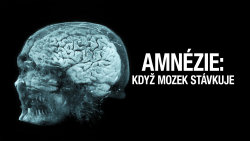 Amnézie: Když mozek stávkuje