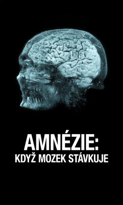 Amnézie: Když mozek stávkuje