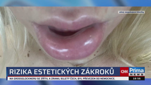 HLAVNÍ ZPRÁVY, 5.6. v 18:55