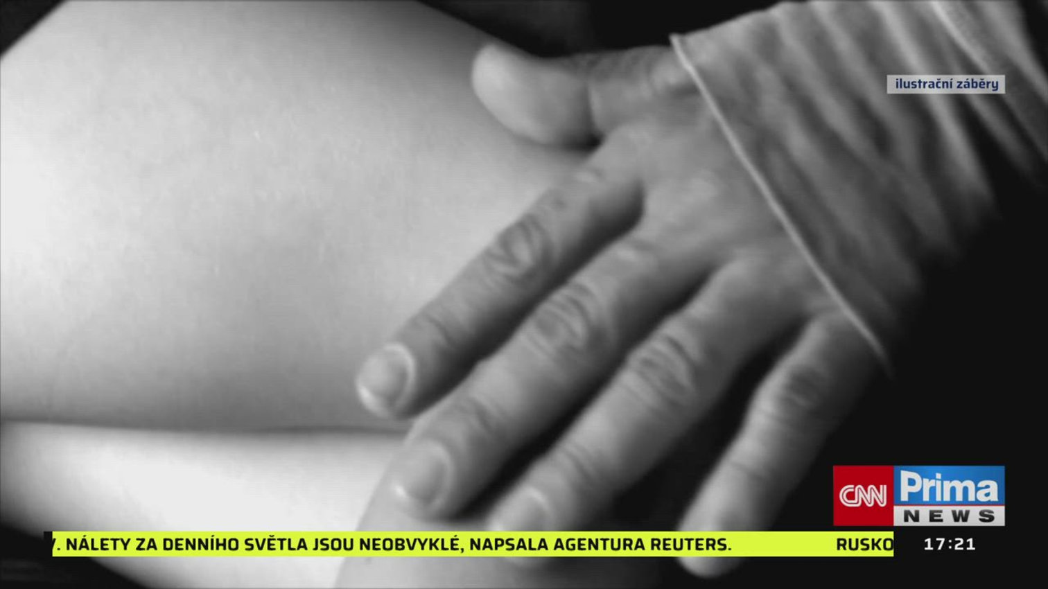 Náhled videa