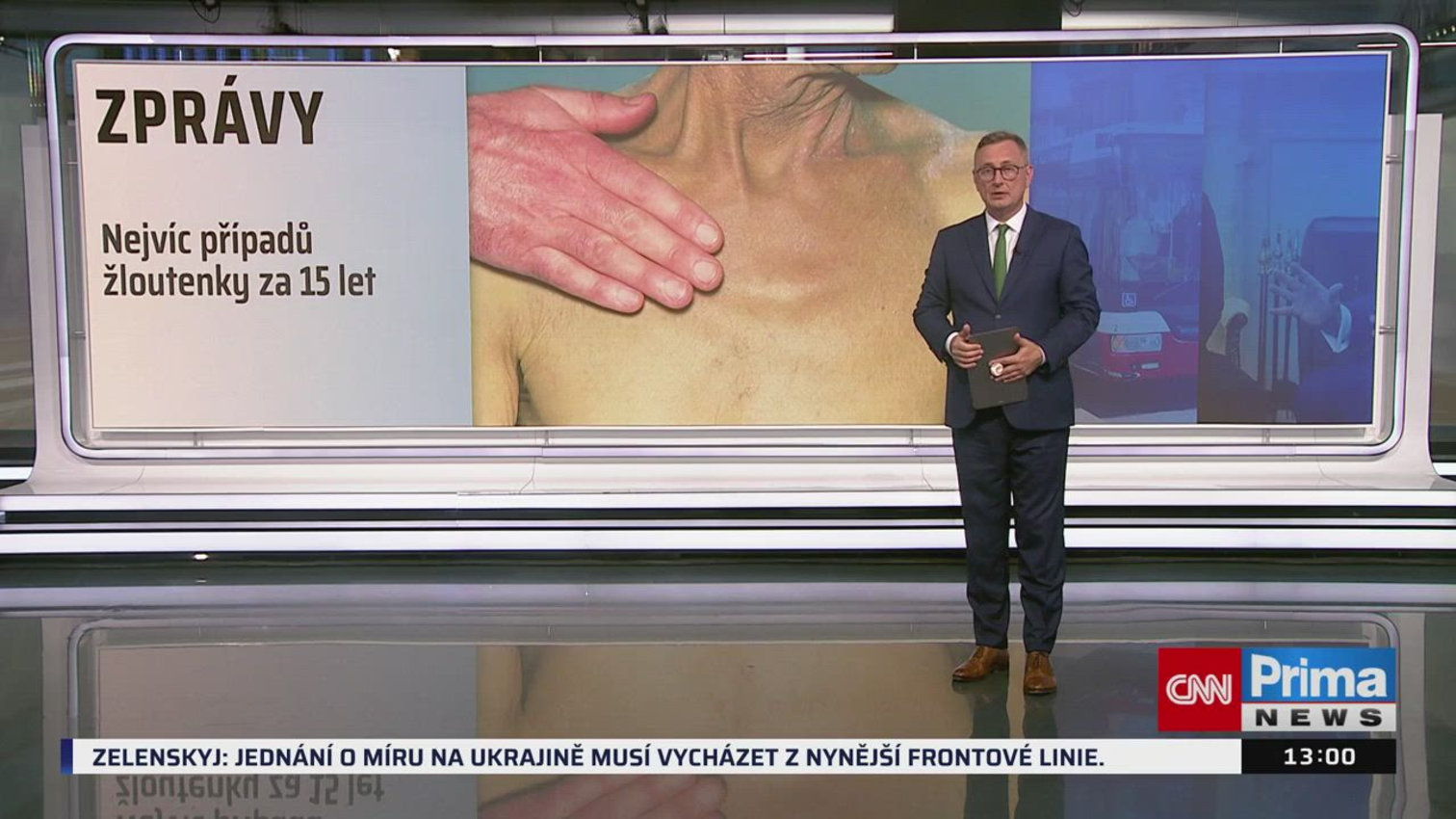 Náhled videa