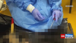 Dvě ženy na veterině v Praze-Řepích odřízly mrtvému psovi čenich