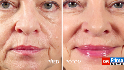 Estetika bez cenzury, 21.2. v 14:15